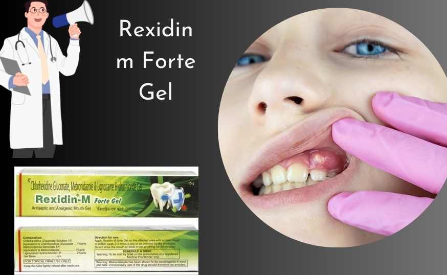 Rexidin M Forte Gel
